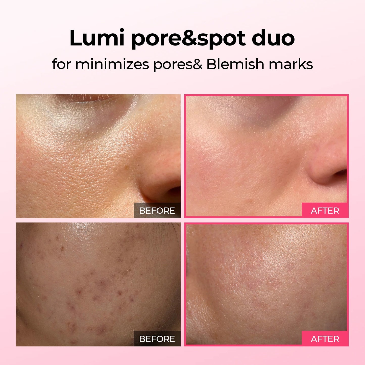 RICE PEEL GLOW SERUM AMPOULE - Dr.Melaxin™