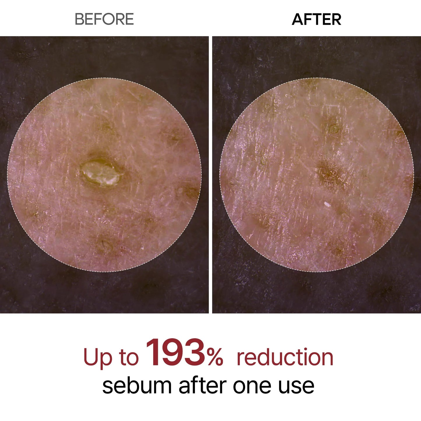 RICE PEEL GLOW SERUM AMPOULE - Dr.Melaxin™