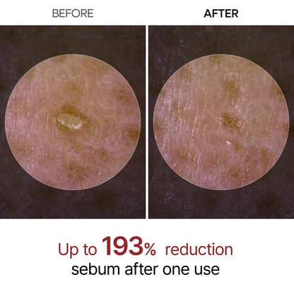 RICE PEEL GLOW SERUM AMPOULE - Dr.Melaxin™
